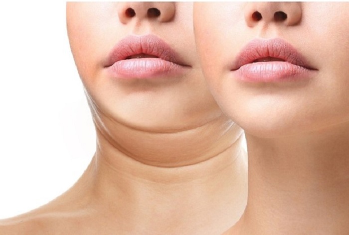 Unveil The Perks Associated With Facial Cosmetic Surgery