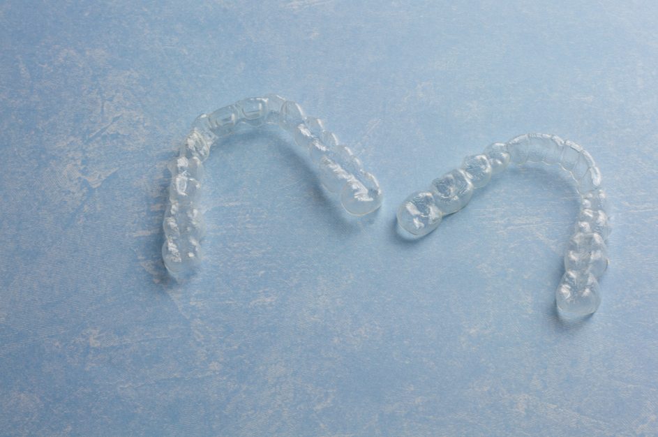 Braces vs. Clear Aligners Which Is Best for You