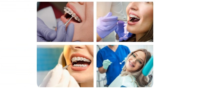 Things Every Patient Must now About Orthodontic Consultation